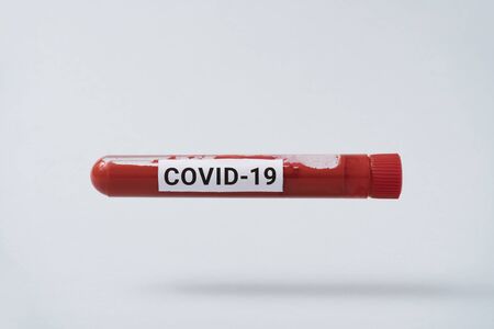 Minimal shot of COVID-19 test and laboratory sample of blood testing for diagnosis new Corona virus infection(novel corona virus disease). Pandemic infectious concept.の写真素材