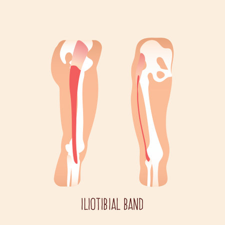 Iliotibial tract vector illustration. Iliotibial band.のイラスト素材
