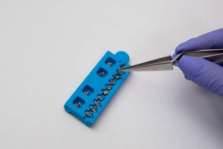 Dental examinations, damond braces system, articulator in a medical clinic