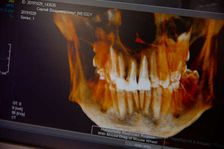 instrument for the dentist, for the treatment and inspection of teeth and bracesの写真素材