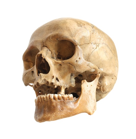 Skull of the person on a white background. Skull of the person on a white background.