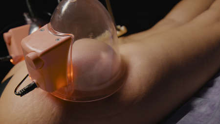 Woman Receiving Vacuum Cupping Device, Butt Skin Lifting Therapy Pump Lifting Enhancer Cup Machine...