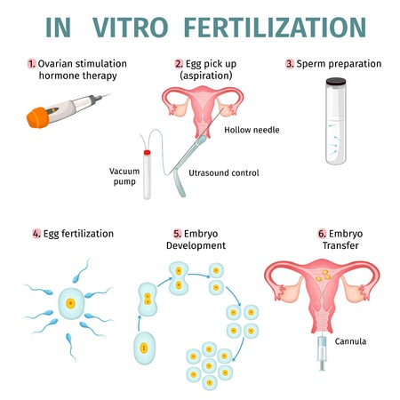In Vitro Fertilization Conceptのイラスト素材