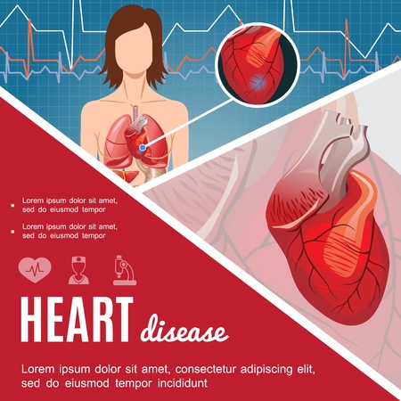 Colorful medical poster with heart anatomy and woman body in cartoon style vector illustrationのイラスト素材