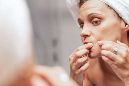 Adult woman looking in the mirror and squeezing a pimple.の写真素材