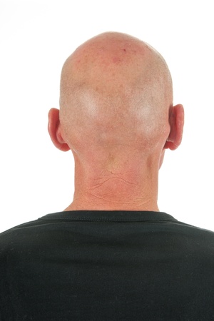 Bald man at backsideの写真素材