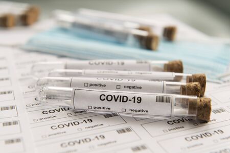 Many covid-19 test tubes for lots of testing