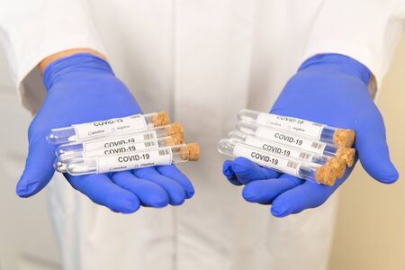 Many covid-19 test tubes inhands of a doctorの写真素材