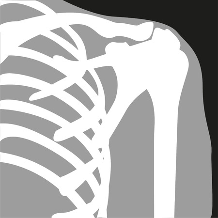X-ray. Shoulder joint. Symbol. Vector illustration.のイラスト素材