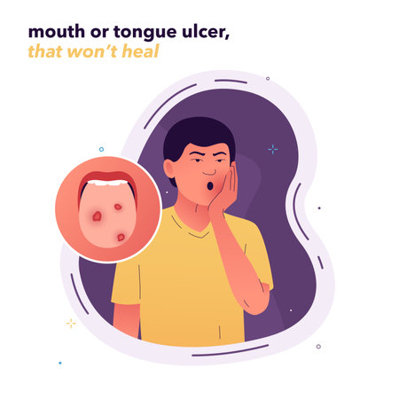Vector illustration of a man with ulcers on his tongue. Non-healing wounds in the oral cavity. A man holds his face with his hand because of pain in his mouth. Symptoms of stomatitis, tuberculosisのイラスト素材