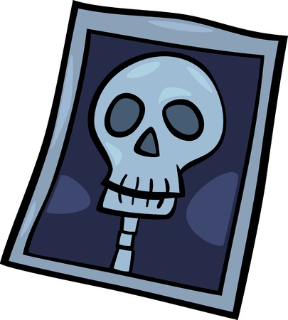 Cartoon Illustration of X-ray Photo of Human Head Clip Artのイラスト素材