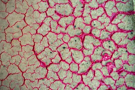 covid19 lung coronavirus virus affected reconstruction detailの写真素材