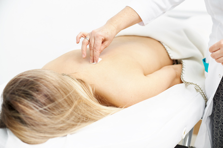 Macro detail of female hand using an insertion tube to insert a Goshin acupuncture needle in the back of a female patient.の写真素材