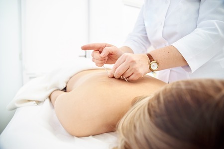 Macro detail of female hand using an insertion tube to insert a Goshin acupuncture needle in the...
