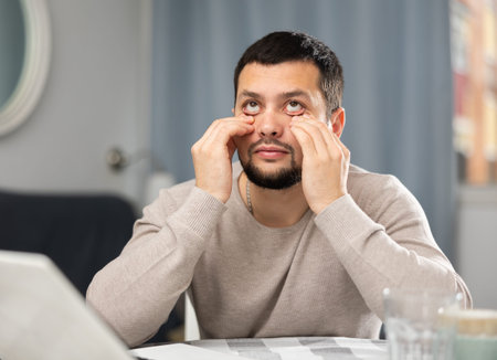 Young man suffering from eye pain after work on laptop at home