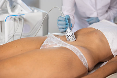 Hardware anti-cellulite procedure on belly of young woman in beauty clinicの写真素材