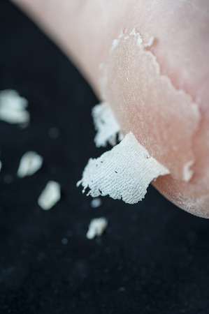 Dry skin peel from cracked heel, black background, macro lens shootingの写真素材