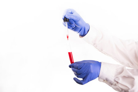 Medical worker's hands with protective, blue, nitrile gloves, holding a test tube and taking a blood...