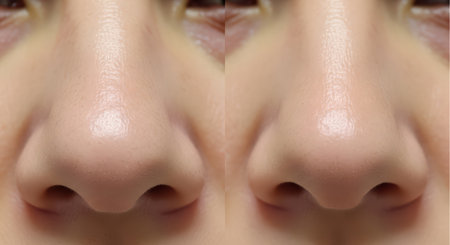 Close-up shot of a person's nose, showcasing its shape and texture. The image highlights the details and structure of the nose.の素材