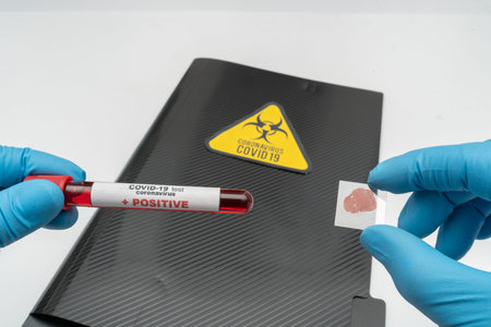 Doctor holds COVID 19 Coronavirus vaccine in his hand, infected blood sample in the sample tube,...