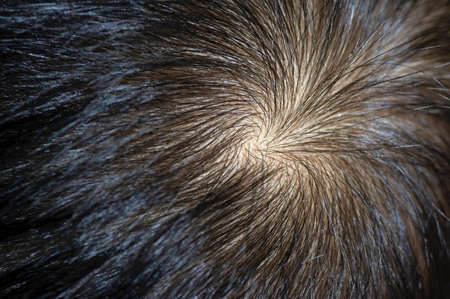 A hair whorl, a circular direction around center point on the human head, selected focusの写真素材