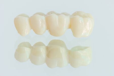 4 unitsâ zirconiaâ bridgeâ withâ all porcelain with a reflection on the glass.の写真素材