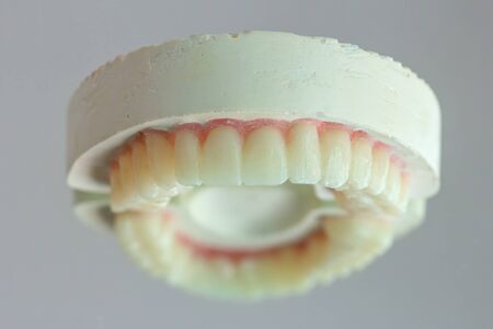 Temporary crowns in the plaster modelâ for dentalâ Treatmentâ with a reflection on the glass.の写真素材
