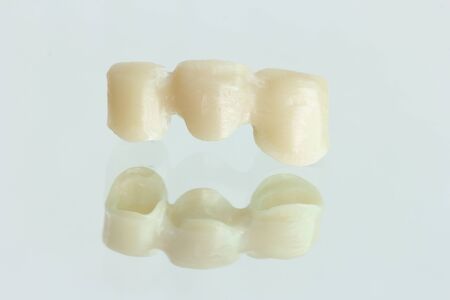 The effect of longâ zirconia âbridgeâ  beforeâ fixing to the patient with a reflection on the glass.の写真素材
