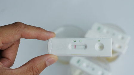 Several clear cups of urine were placed on the table, ready for the inspector to examine the...