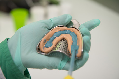 Close-up Shot Of Dental Impression With Implantの写真素材