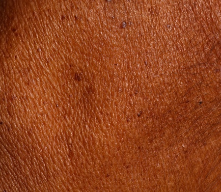 Close up of Skin background.の写真素材