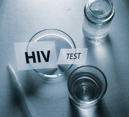 HIV test tags in laboratory background