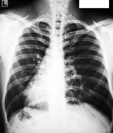 collection of x-rayの写真素材