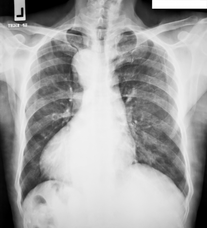 collection of x-rayの写真素材