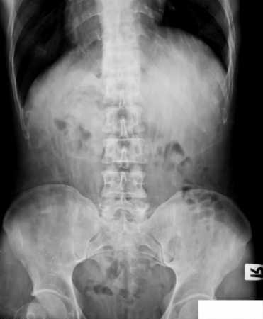 collection of x-rayの写真素材