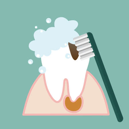 Brushing Teeth. Toothbrush hold in hand man. Dental care concept. Toothpaste bubbles foam. Oral hygiene. Vector illustration.のイラスト素材