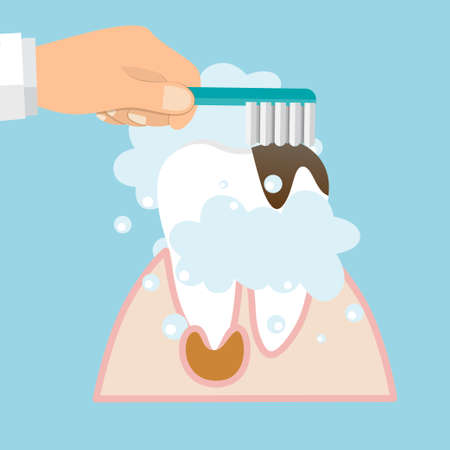 Brushing Teeth. Toothbrush hold in hand man. Dental care concept. Toothpaste bubbles foam. Oral hygiene. Vector illustration.のイラスト素材