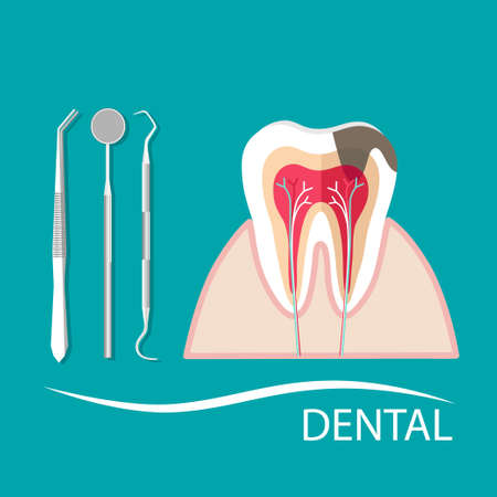 Hand holding instruments for examining patient teeth. Teeth examination dentistry concept.Â のイラスト素材