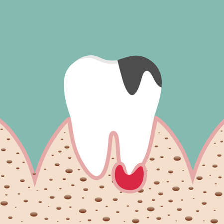 Dentist holding instruments and examining patient teeth. Teeth examination dentistry concept.Â のイラスト素材