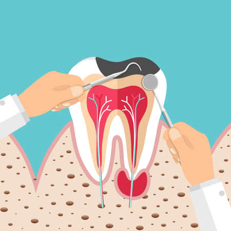 Dentist holding instruments and examining patient teeth. Teeth examination dentistry concept.Â のイラスト素材