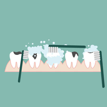 Dentist with instruments for dental treatment. Teeth examination dentistry concept.Â のイラスト素材