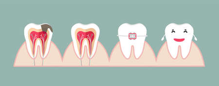 Dentist and Human teeth. Dental care background. Vector illustration.のイラスト素材