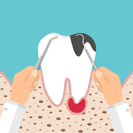 Dentist holding instruments and examining patient teeth. Patient mouth inside view. Teeth examination dentistry concept.Â のイラスト素材