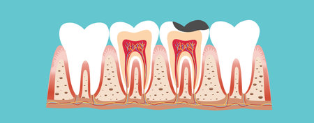 Dentist and Human teeth. Dental care background. Vector illustration.のイラスト素材