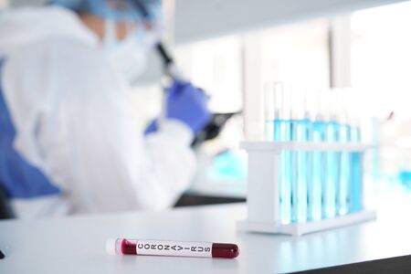 coronavirus covid 19 check, researchers are finding ways to eliminate the corona virus vaccine. Blood tests for the Covid virus research experts with test tubeの写真素材