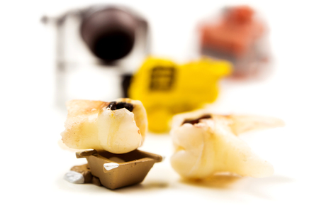 little miniature figurines workers fixing the problem with big caries on milk tooth molar by working on transportation of problematic tooth away on white backgroundの写真素材