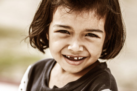 Little child with broken teeth 