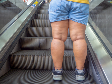 fat women leg standing on escalatorの写真素材