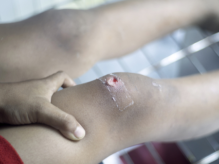 Students play the puck falls into a deep leg injuryの写真素材