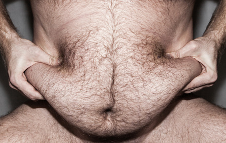 Obesity - fat bellyの写真素材